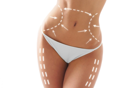 Body lift surgery in Turkey