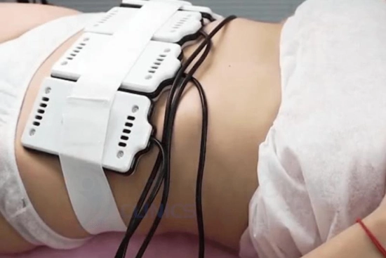 Advantages of laser liposuction 2026 Advantages of laser liposuction 2026