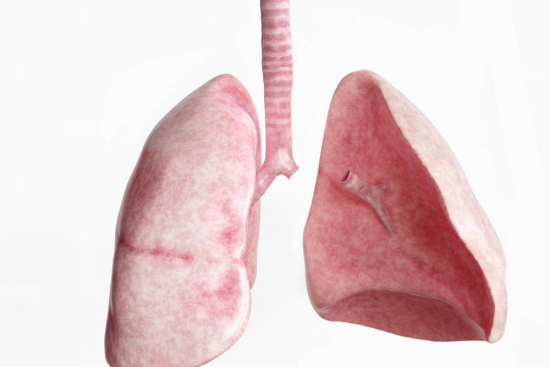 استئصال الرئة تركيا