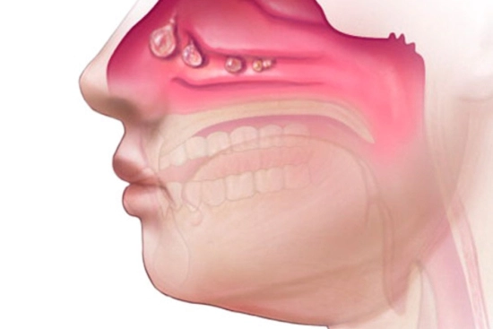 Восстановление после операции: чего ожидать по неделям 2026 Восстановление после операции: чего ожидать по неделям 2026