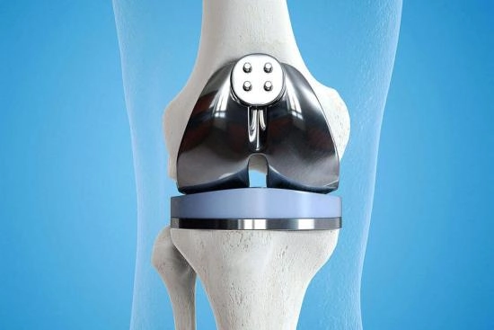 knee replacement prosthesis