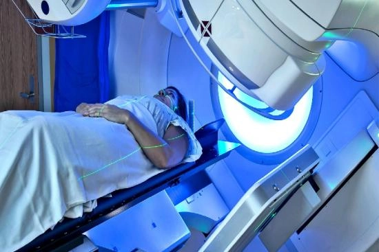 The side effects of the Radiation Therapy 2024