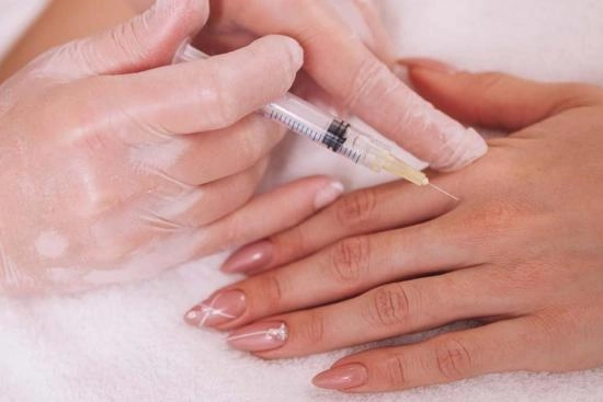 Hand rejuvenation in Turkey