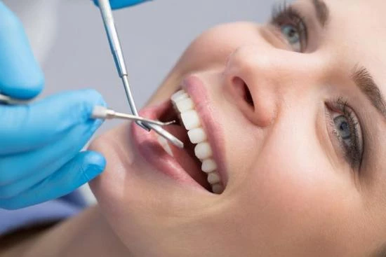 Facettes dentaires en Turquie - Prix 2023 - Heva Clinic Turquie