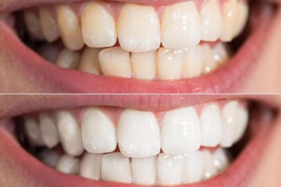 of our patients 1 prices, dental care, clinic,Turkey, Istanbul