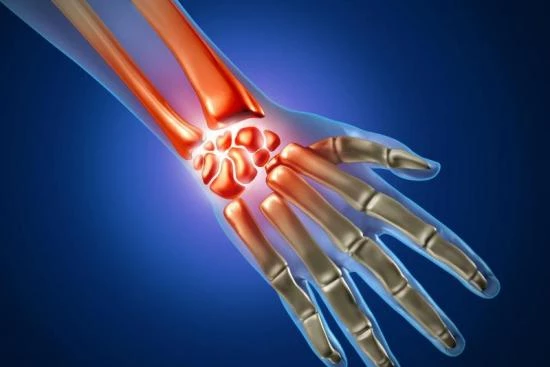 Causes of carpal tunnel syndrome 2024