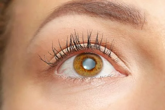 أنواع أورام العين