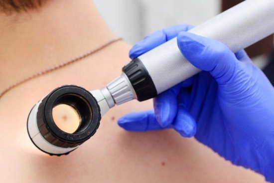 Symptoms and early diagnosis of skin cancer 2026