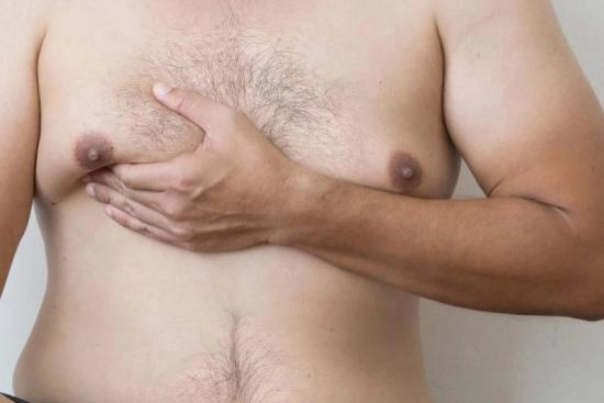 Diagnosing Gynecomastia in Turkey 2024