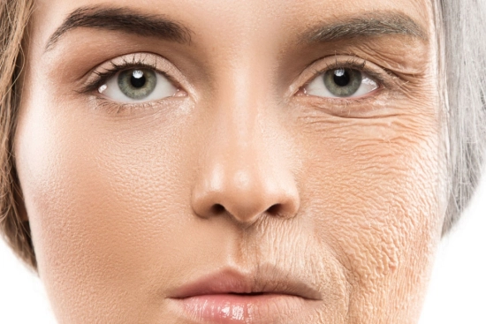 Where do wrinkles & fine lines appear? 2025