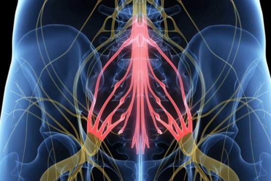 Causes of Cauda Equina Syndrome 2024