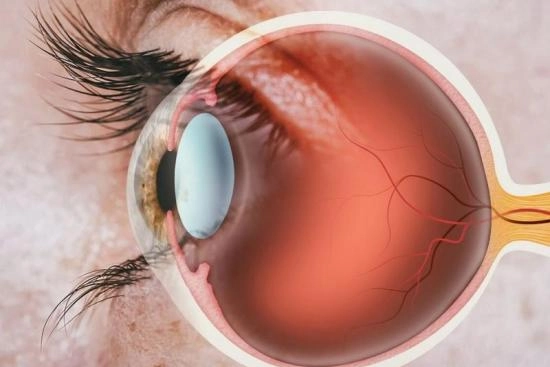 Retinal transplantation Turkey 